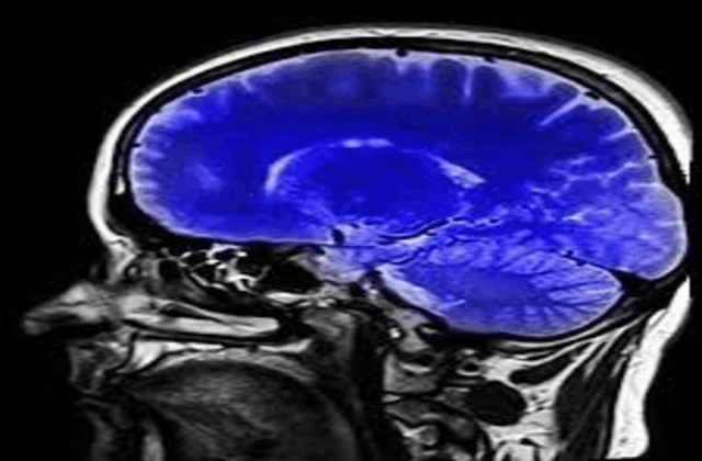 Deep Learning Model for Image Classification